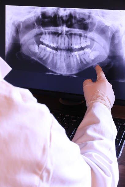 Best Emergency Dental Surgery in Golden, CO